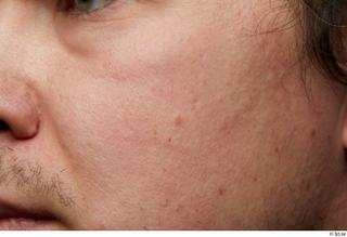 HD Skin Brandon Davis cheek face head skin pores skin…